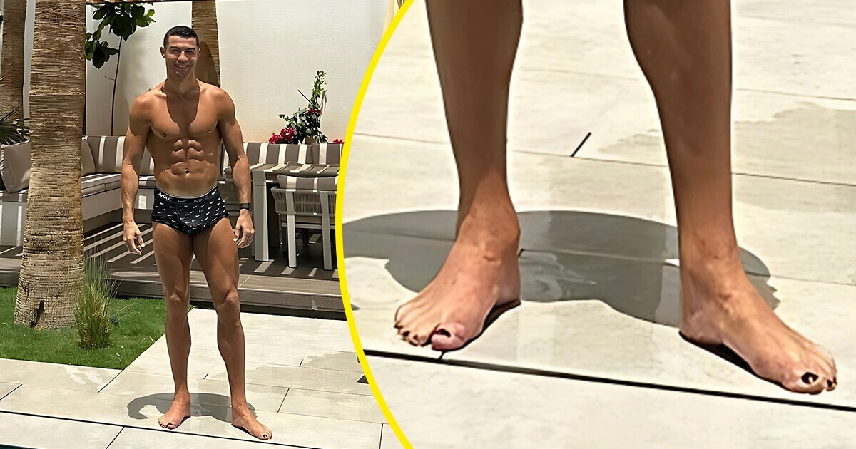 Giải mật thể thao: Móng chân sơn đen của Ronaldo